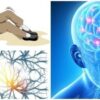 epilepsia-665x310-1 FRT-15C3