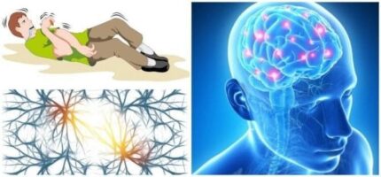 epilepsia-665x310-1 FRT-15C3